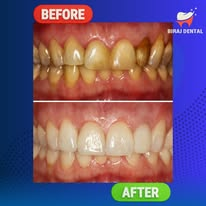 Cleaning & Polishing Result